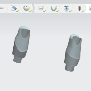 Customized Abutments
