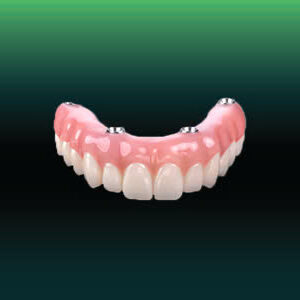 All On Four Implants