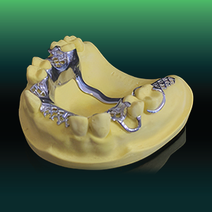 Cr-Co Framework in SGTD Dentallab production