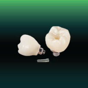 Full Zirconia Screw Retained