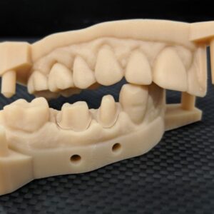 Partial Dental Model