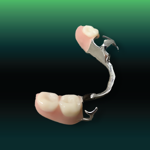 Metal Frame Partial Denture