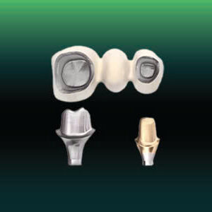 PFM on Implant restoration in SGTD Dentallab production