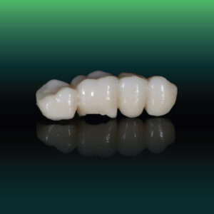 Zirconia 3D Multilayer in SGTD Dentallab production