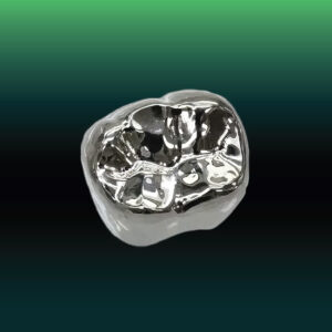 FMC Non Precious Crowns Value