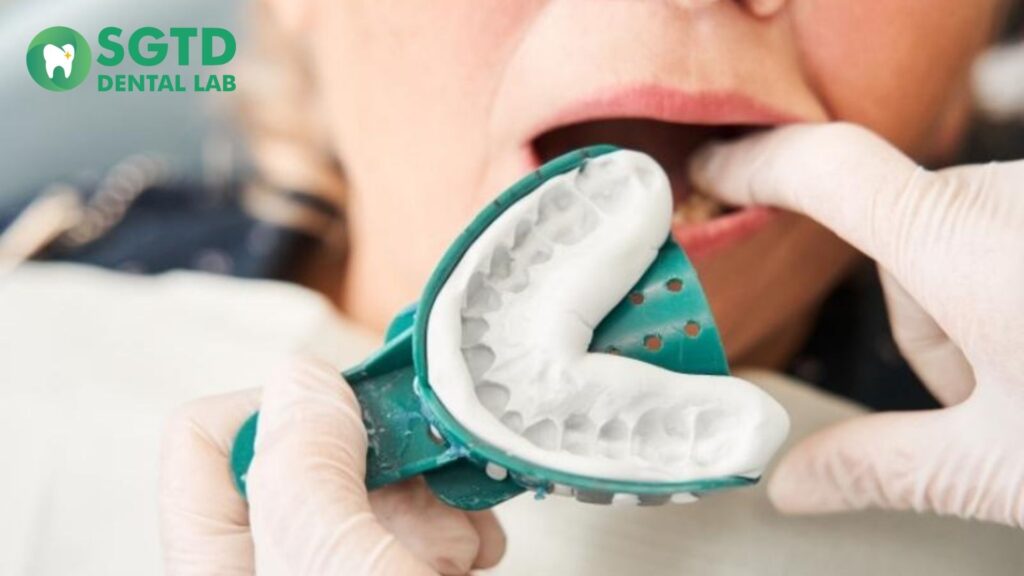 Dentist taking dental impressions for Crown & Bridge.