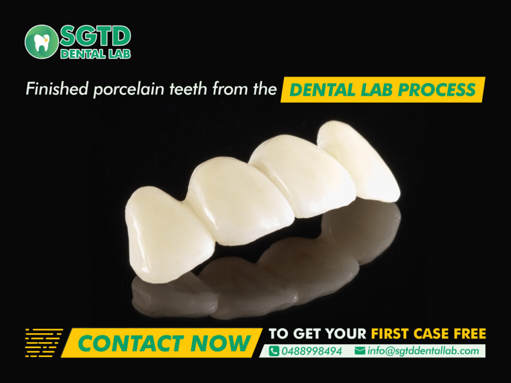 Finished porcelain teeth Crown Fabrication Workflow from the dental lab process