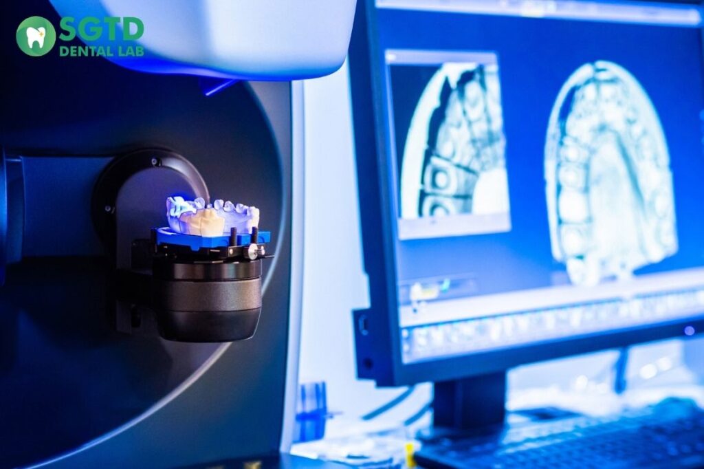 What Are e.max Crowns CAD/CAM Tech